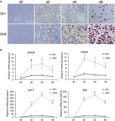 Association of growth hormone deficiency with an increased number of preadipocytes in subcutaneous fat